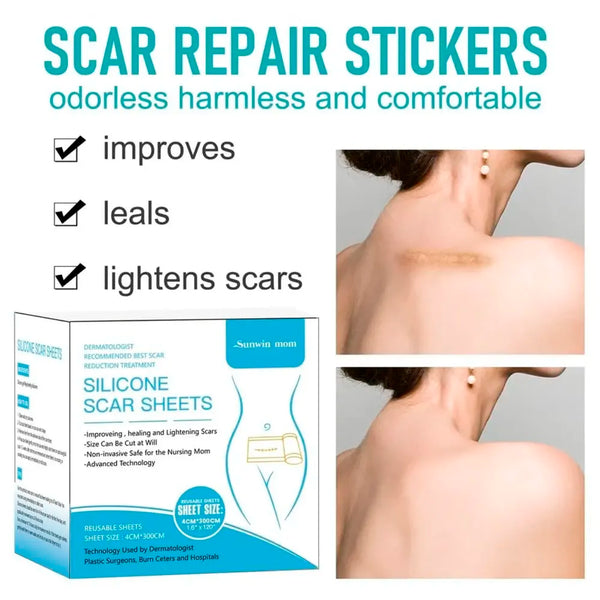 Bioline Silicon Scar Sheet 4 x 150 Cm for Healing Scars Transparent tear silicone tape roll for hypertrophic scars and keloids caused by surgery, medical silicone for scar removal - 6